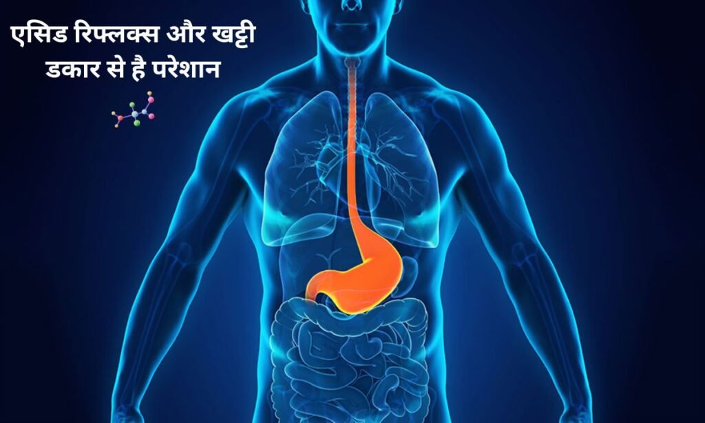 एसिड रिफ्लक्स और खट्टी डकार से है परेशान, आज ही फॉलो करें इस जानकारी को