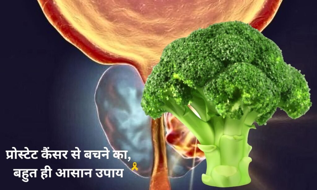 प्रोस्टेट कैंसर से बचने का, बहुत ही आसान उपाय